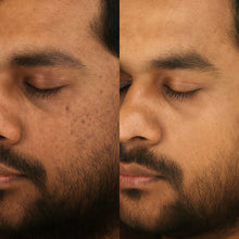 Porephil™ – Zero Pore Cleanser