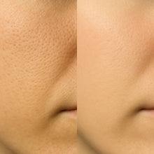 Porephil™ – Zero Pore Cleanser