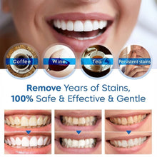 Smyle™ - Teeth Whitening Pen